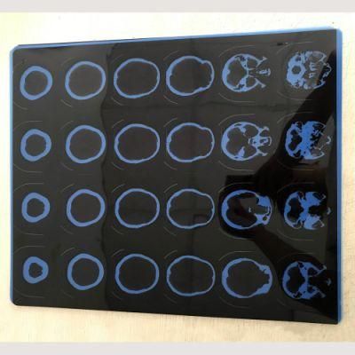 Printing Radiology Universal Medical Thermal Hospital Blue X-ray Film