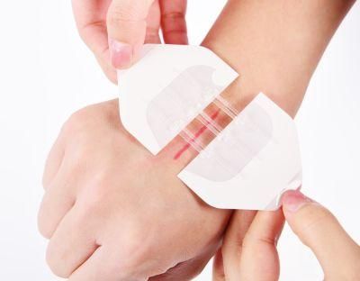 Medical Adhesive Disposable Wound Dressing Wound Closure Device Plaster