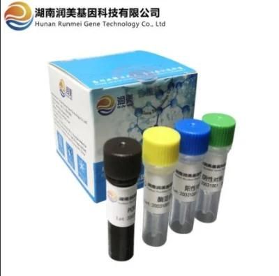 Seasonal Type a (H1N1, H3) Influenza Virus Double Rna Detection Kit