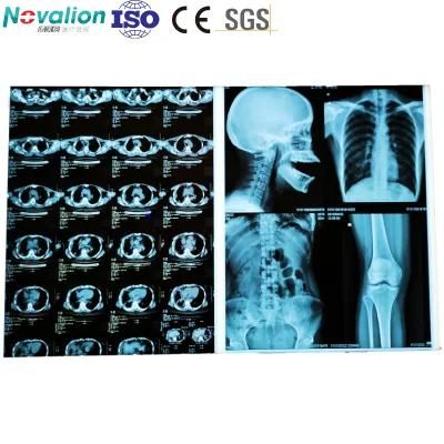 Blue Inkjet Film Professional Production Inkjet Medical X-ray Film