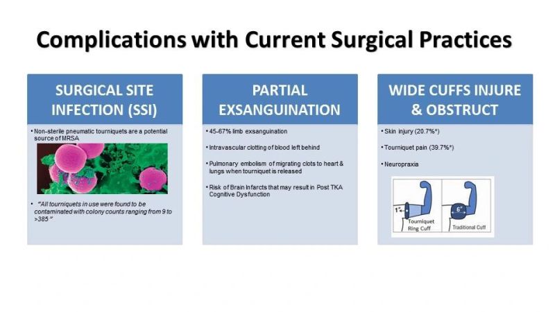 Easy to Use Sterile Tourniquet Latex Free Elastic Exsanguinating Tourniquet Ring Pneumatic Tourniquet to Provide Bloodless Environment in Limb Surgery