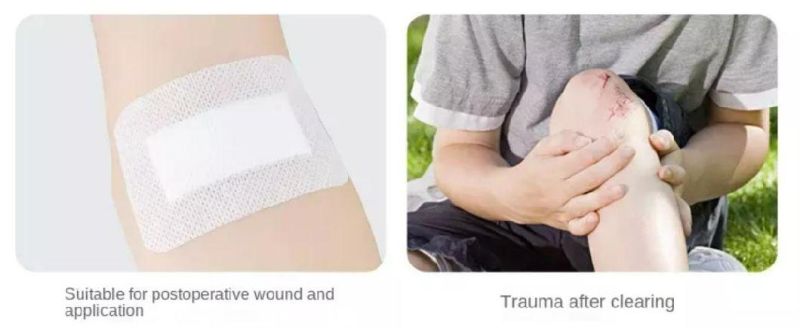 Non-Woven Super Absorbent Wound Dressing Adhesive Wound Dressing