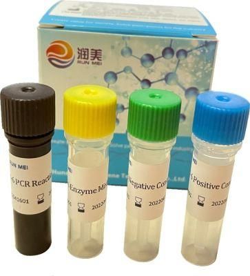 Influenza Virus (type A, B) , New Coronavirus (ORF1ab gene, N gene) Quadruple Nucleic Acid Detection Kit (fluorescence PCR method)