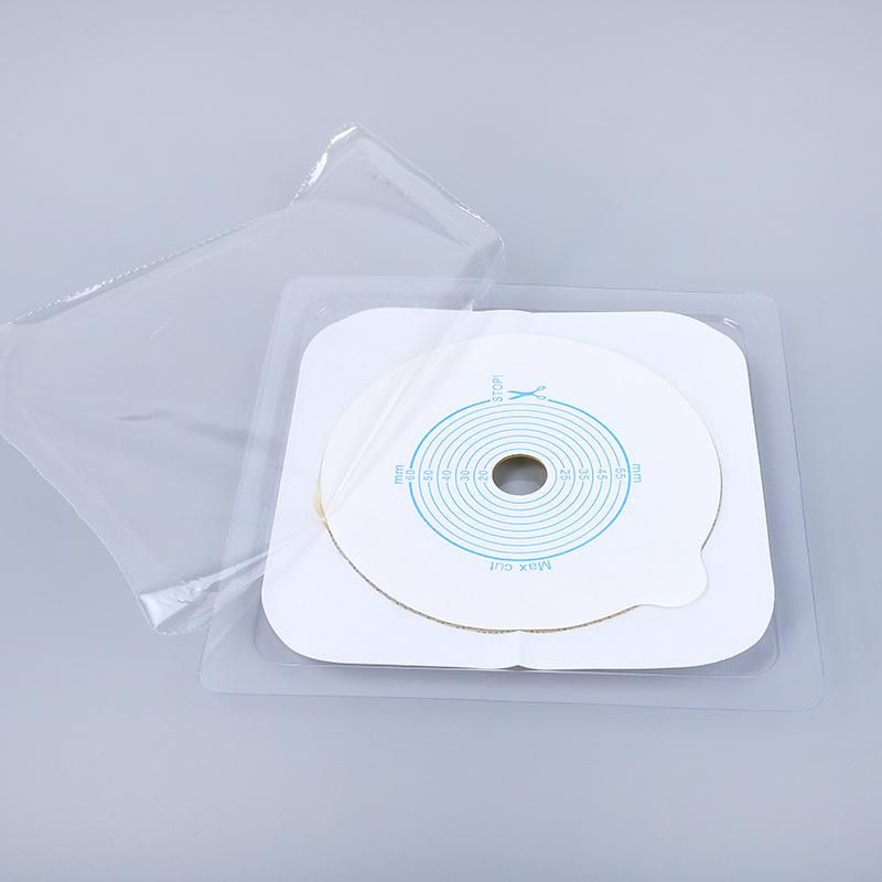 Factory Stoma Medical Urostomy Colostomy Urinary Ostomy Chassis