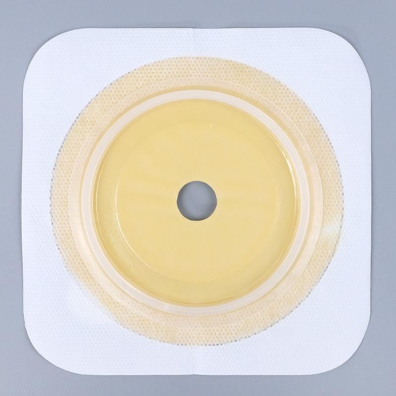 Factory Stoma Medical Urostomy Colostomy Urinary Ostomy Chassis