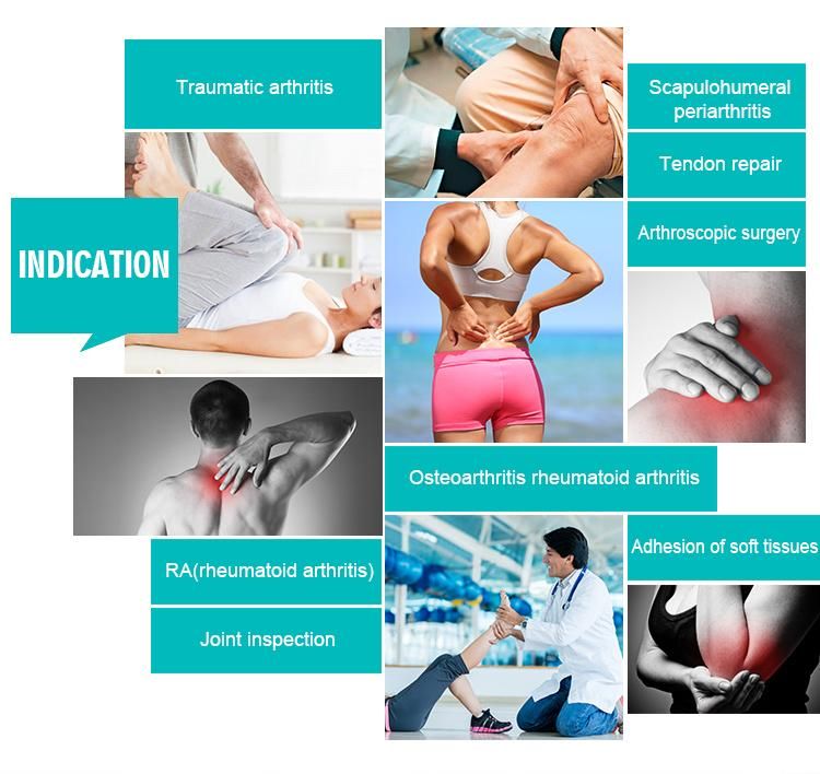 3ml Non-Crosslinked Hyaluronic Acid Knee Joint Injection for Osteoarthritis