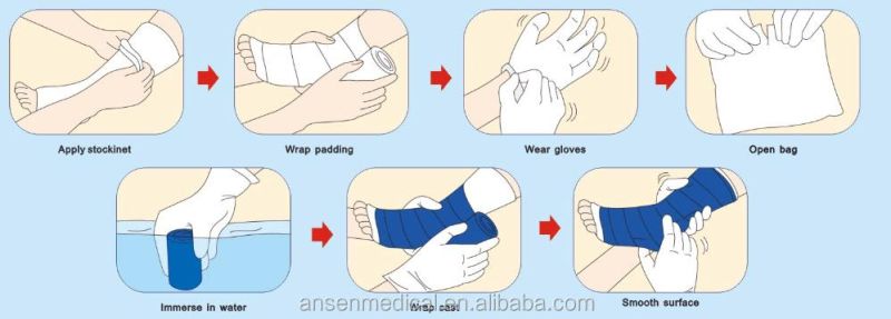 Fiberglass Fabric Multi-Color Medical Orthopedic Plaster of Pairs Bandage
