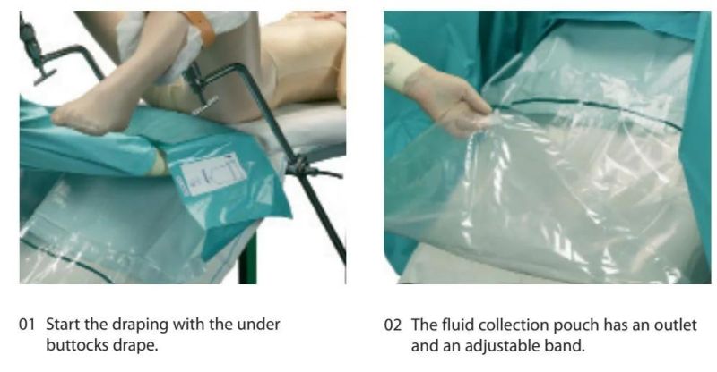 Obstetric and Gynecological Procedures Used of Under Buttock Drape