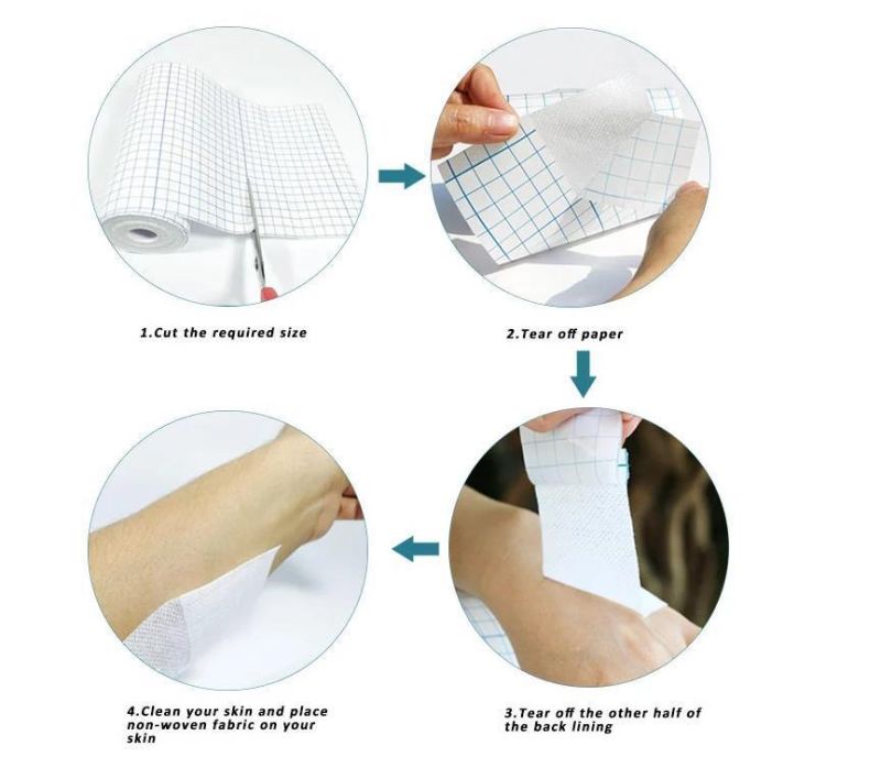 Mdr CE Approved Advanced Sterile Disposable Medical Non Woven Fabric Tape