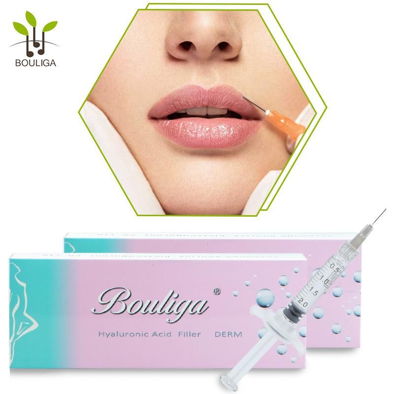 Hyaluronic Acid Dermal Filler for Lip Fullness 2ml