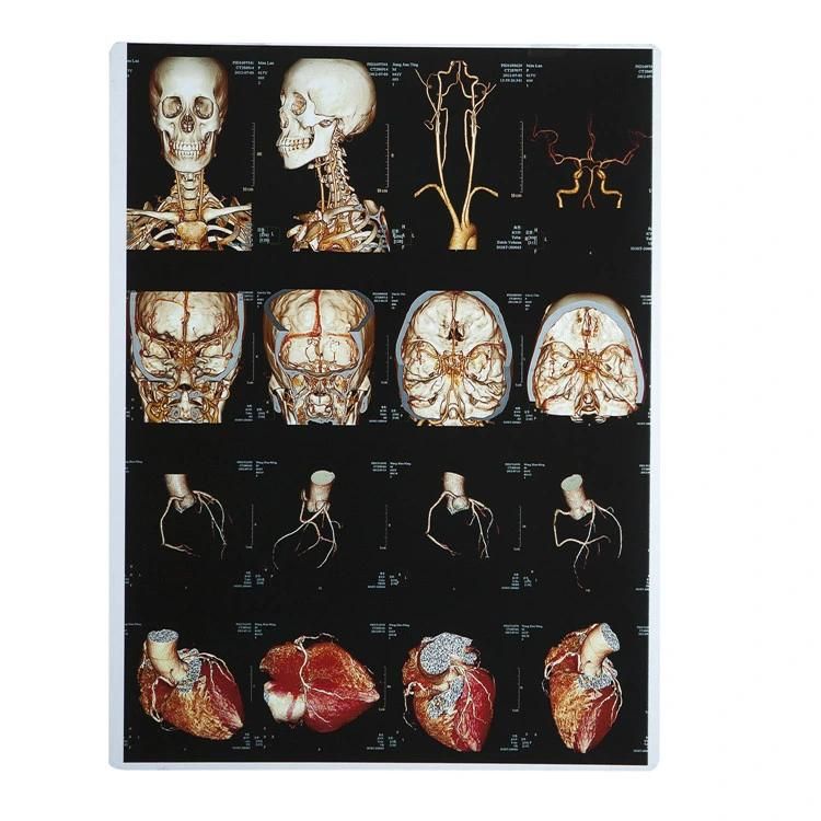 Radiographic Medical X-ray Film Imaging