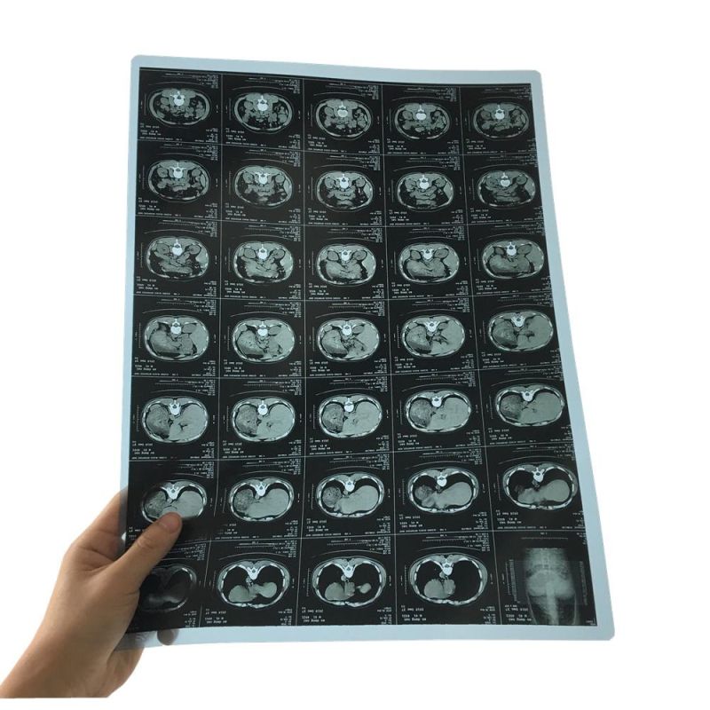 Thermal Medical X Ray Image Blue Films