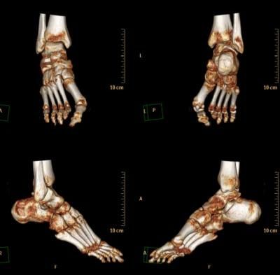 180 Micron Pet Medical White Inkjet X Ray Film