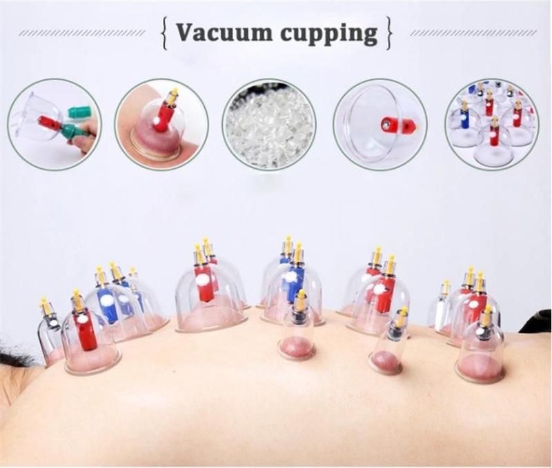 Chinese Cupping Therapy Set Manufacture Cups