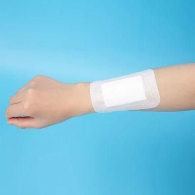 Nonwoven Adhesive Wound Dressing