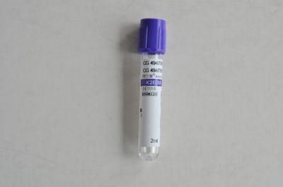 Vacuum Blood Collection Tube (EDTA K2/EDTA K3 2ml)