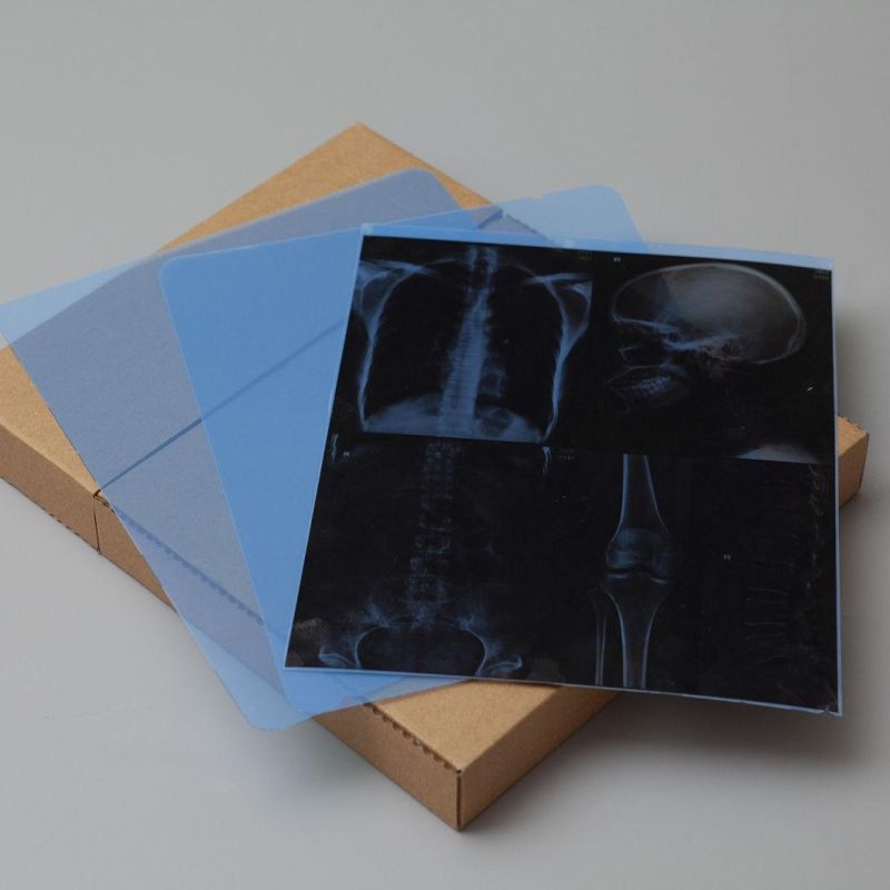 Thermal Medical X Ray Image Blue Films