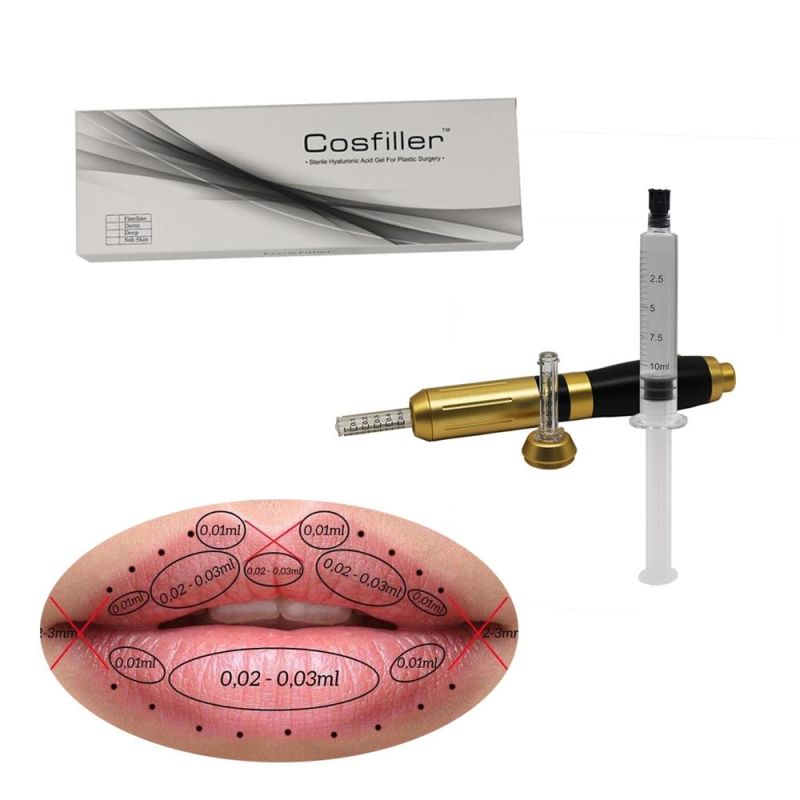 High Quality Ha Filler Injection Cross Linked Hyaluronic Acid Gel Injectable Dermal Filler