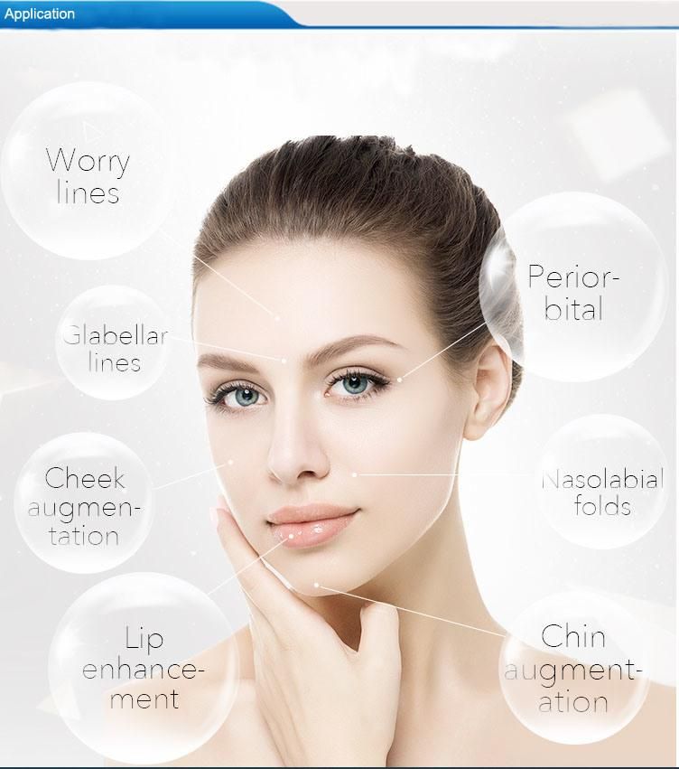 Injectable Hyaluronic Acid Lip Filler Replengen Filler