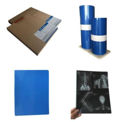 Agfa Printer Usage Medical X-ray Blue Thermal Films