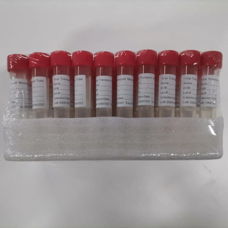 Vacuum Urine Collection Tube with Urine Container