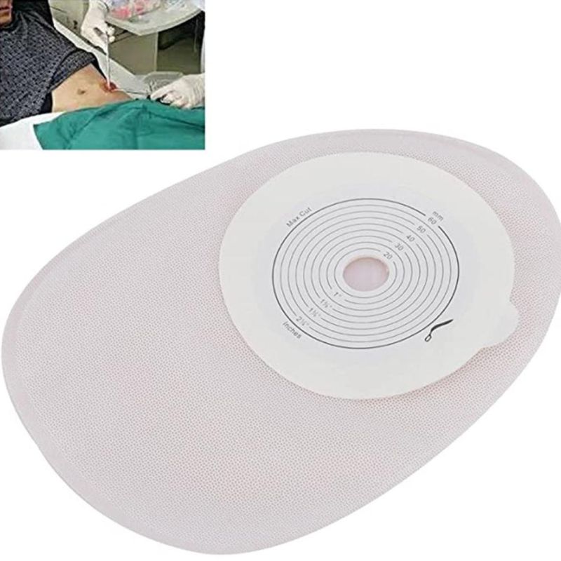 Hb Disposable Colostomy Bag, Patch Skin, Colostomy Care Bag