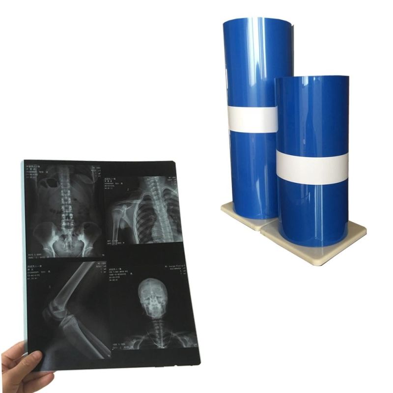 Dry Thermal Medical Film Blue Color