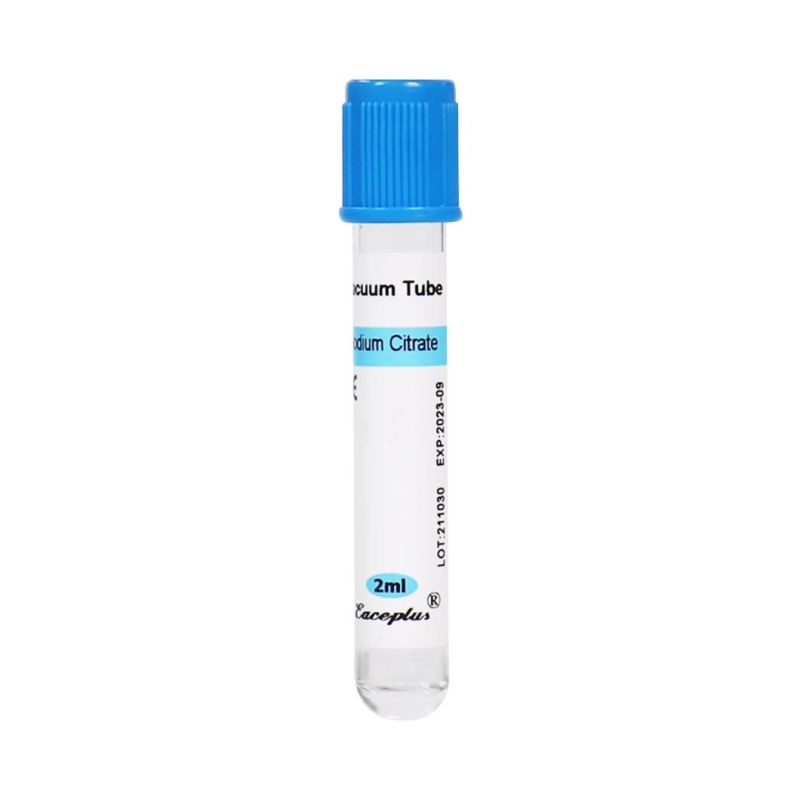 Siny Wholesale Hospital Vacuum Blood Collection Tube Sodium Citrate 2ml with CE