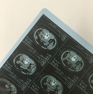 8X10 Inch Blue Color Medical X-ray Dry Film Compatible with Agfa Printer