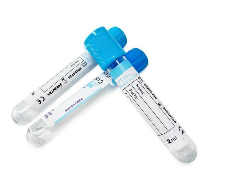 Laboratory Coagulation Test Sodium Citrate Vacuum Blood Collection PT Tube