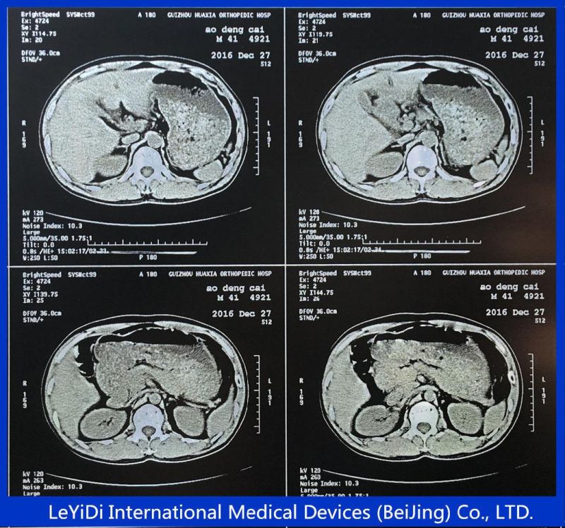 Leyidi Medical X Ray Film Blue Sensitive Films