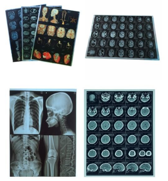 Roll Packing Blue Thermal Medical Digital Dry Images