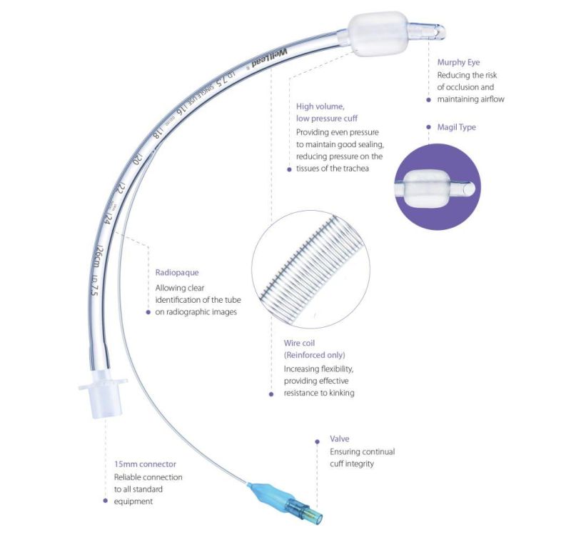 Endotracheal Tube with High Volume Low Pressure Cuff