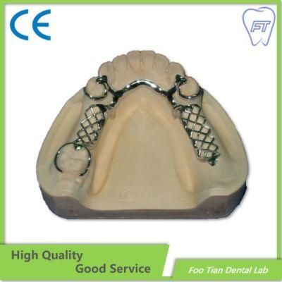 Hot Sale Cast Partial Framework Denture