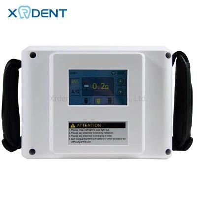 Super Cheaper Digital Portable X-ray Machine Factory Supply