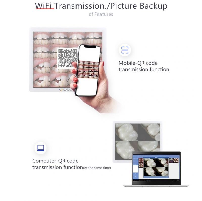 High Definition Endoscope with Integrated Intraoral Camera, Wi-Fi Transmission