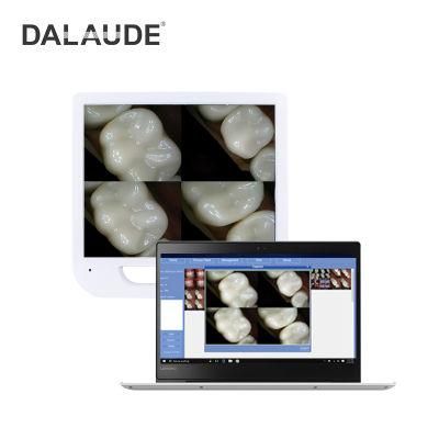 Dental Endoscope Intraoral Camera with HD Monitor