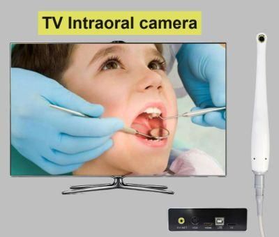 1080P TV Oral Camera Super Clear Image Vivid Show on Big Screen