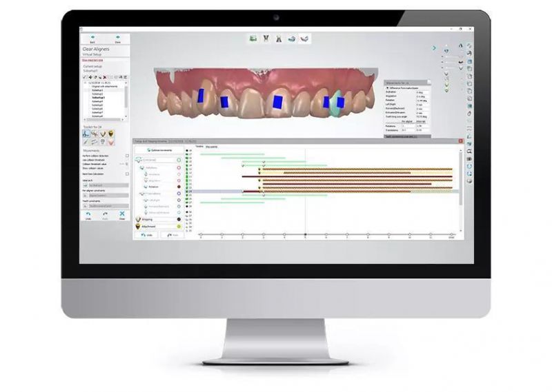 Straighten Teeth at Home /Invisible Braces for Teeth Correction/Orthodontic Invisible Aligners