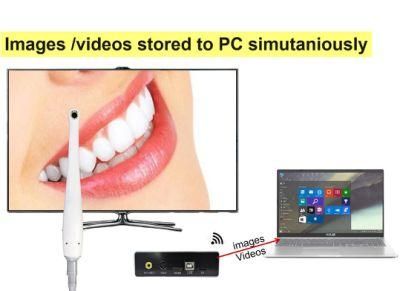 Mini Control Box Digital TV Intraoral Camera VGA/AV/Hdm/I Ports Output