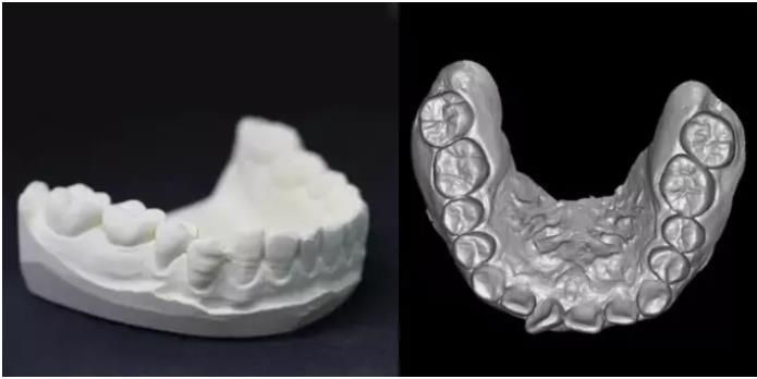 Hires 3D-Plus CE Professional Large Fov Dental 3D Cone Beam Computred Tomography Cbct Equipment