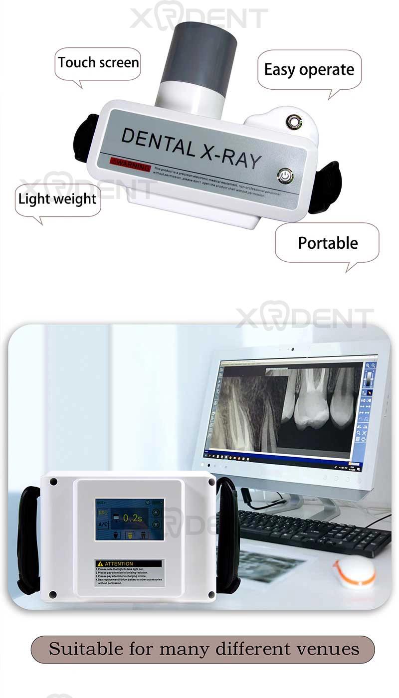 Touch Screen Japan Toshiba Tube Portable Dental X Ray Machine