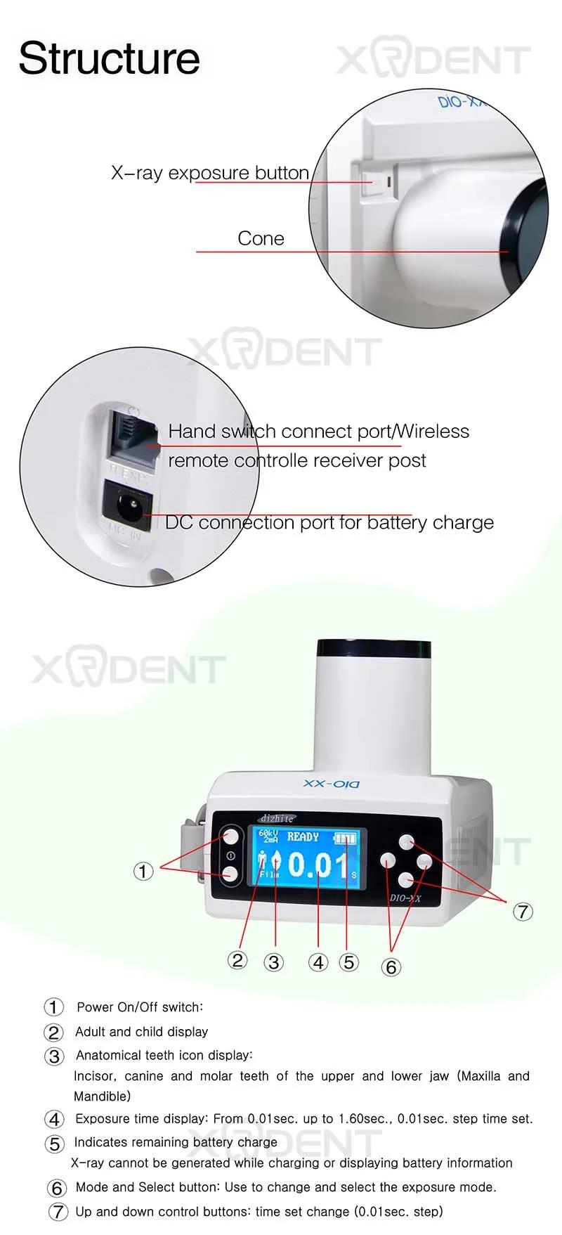 60kv HD Dental Portable X-ray Machine Korea Dio Digital X Ray