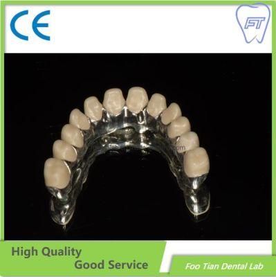 Implant System Hybrid Implant Denture on Selling