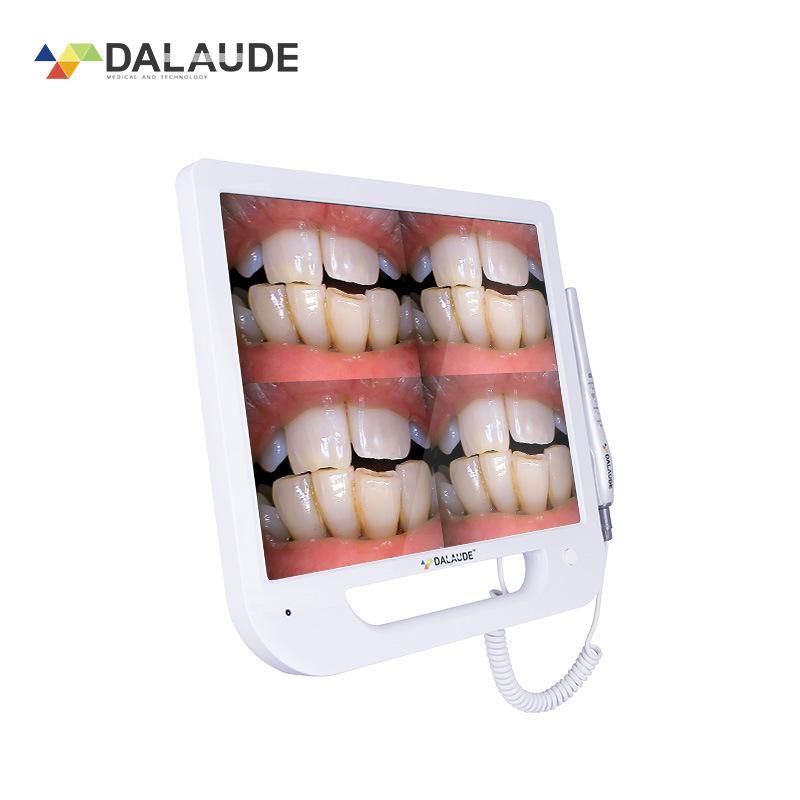 HD Dental Monitor with Versatile Intraoral Camera