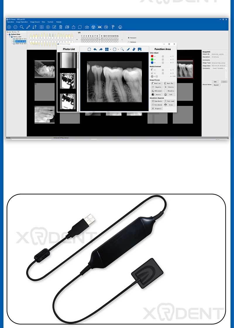 Dental Rvg Sensor Vatech Intra-Oral Imaging Systems