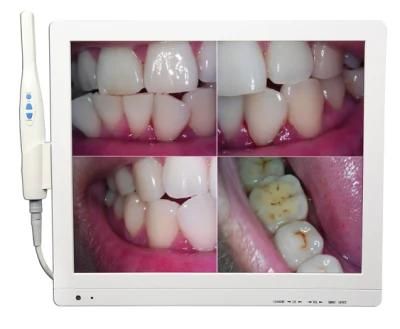 17 Inch HD Screen Intraoral Camera