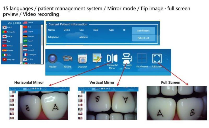 6mm Super Thin Camera Head Dental Intraoral Camera