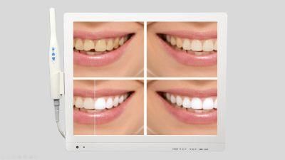 Factory Price Medical Dental Oral Camera