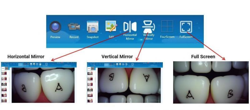 Windows/Linux UVC Camera 2MP High Pixel Dental Intraoral Camera for Dentists